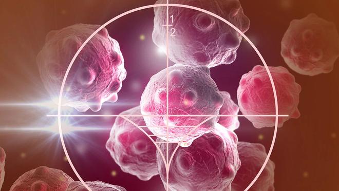 小细胞肺癌全身转移！放化疗+中药双管齐下病灶神奇稳定！